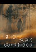 Burn, Scar