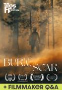 Burn, Scar
