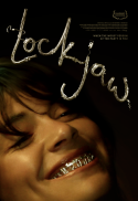 Lockjaw